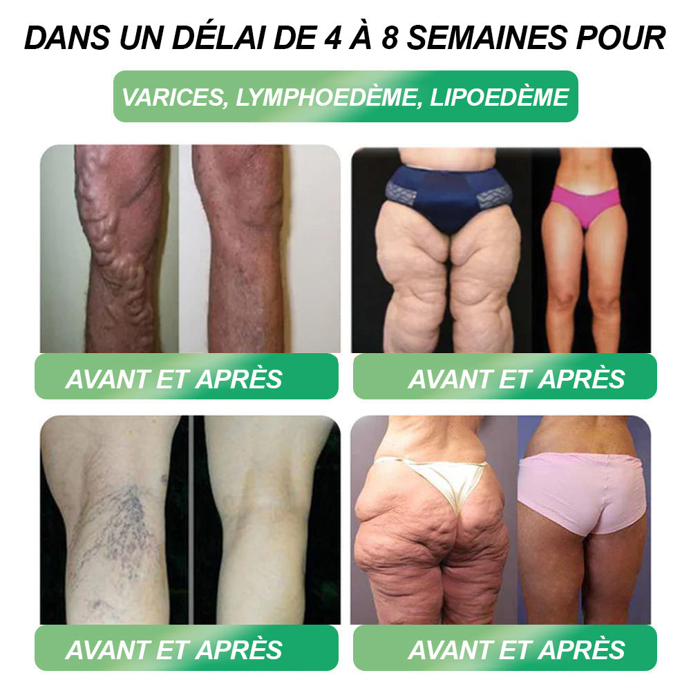 Il ne reste que 10 boîtes !⏰ Profitez d’une remise exclusive de 30 % !Recommandé par des endocrinologues : 4 à 6 boîtes pour stabiliser la perte de poids et éviter la reprise. Dernière chance avant l’an prochain !N’attendez plus !🔥